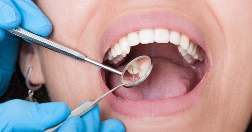 What are the Signs of Dental Health